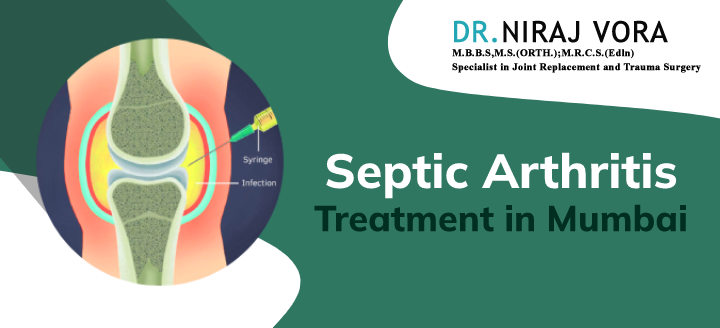 septic arthritis treatment in mumbai - dr niraj vora