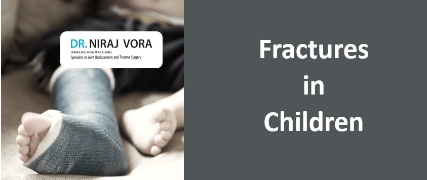 Fractures in Children