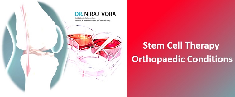 Stem cell therapy for knees