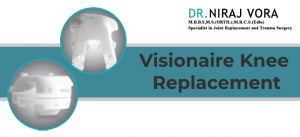 Visionaire Knee Replacement
