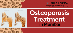 Osteoporosis Treatment in Mumbai | Dr Niraj Vora