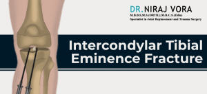 Intercondylar Tibial Eminence Fracture | Dr Niraj Vora