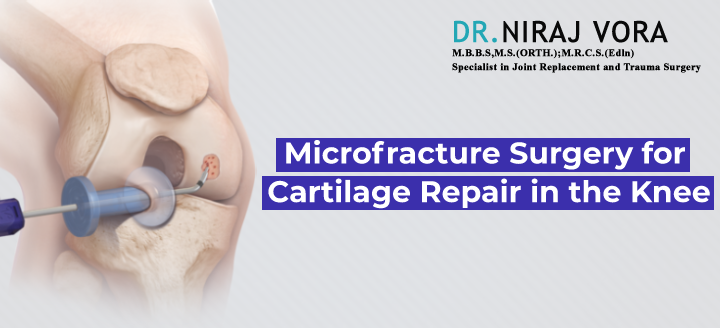 Microfracture Surgery for Cartilage Repair in the Knee | Dr Niraj Vora