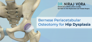 Bernese Periacetabular Osteotomy for Hip Dysplasia | Dr Niraj Vora