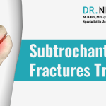 Subtrochanteric Hip Fractures Treatment | Dr Niraj Vora | Dr Niraj Vora