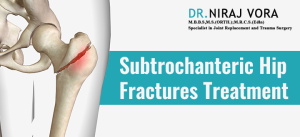 Subtrochanteric Hip Fractures Treatment | Dr Niraj Vora